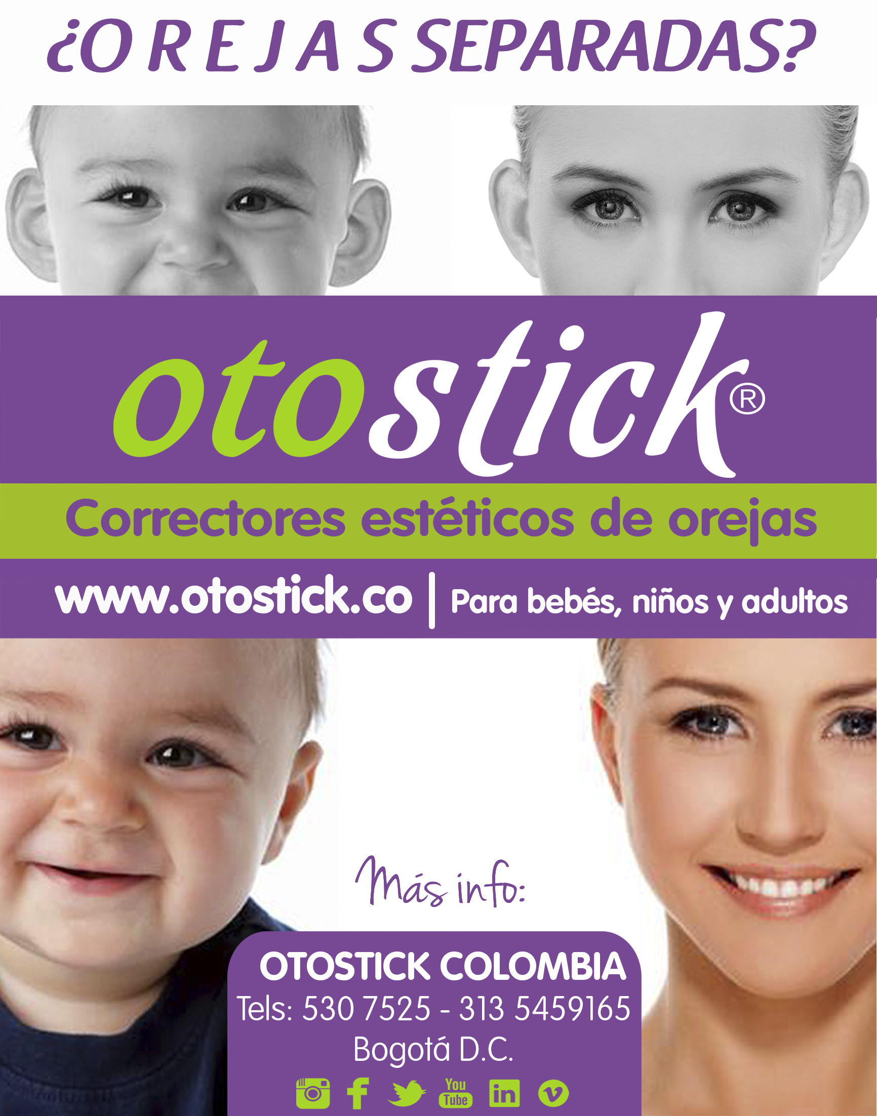 Otostick, Corrector estético para Orejas Separadas